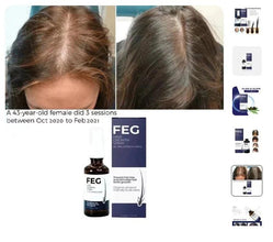 FEG Plus Hair Growth Spray